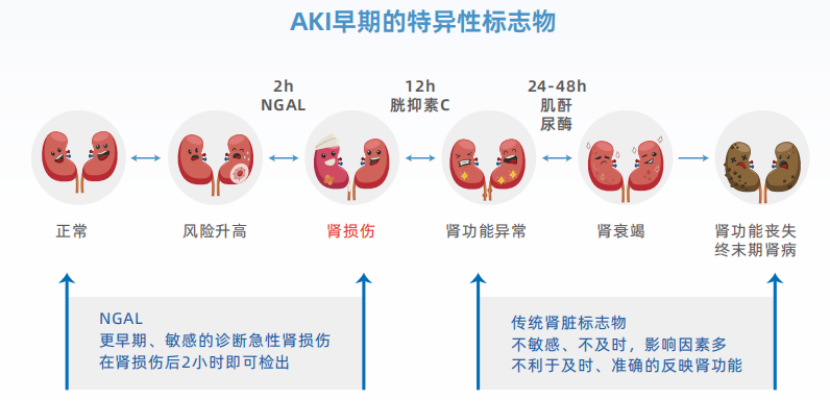 NGAL：中文名記不住，要記住這些臨床價值